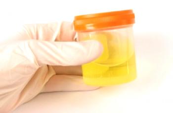 Sladkor v urinu s sladkorno boleznijo tipa 2: Norma in zdravljenje