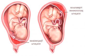 Lo que es peligroso es la placenta previa completa durante el embarazo.