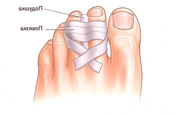¿Qué signos de fractura de un dedo del pie pueden ser?