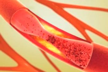 Kako očistiti krvne žile od holesterola. Ljudska zdravila in droge