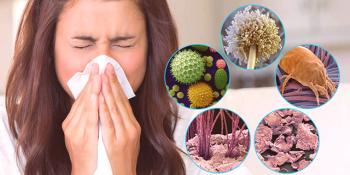 Alergia a la caspa: síntomas y tratamiento