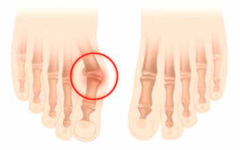 ¿Qué es un tobillo en la pierna?