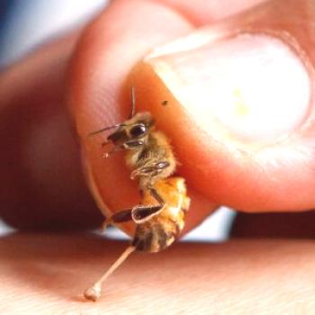 Método de tratamiento de las picaduras de abejas a domicilio.