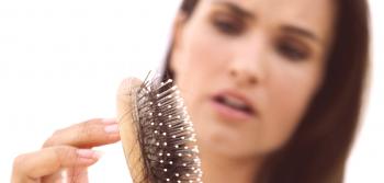 Causas y tratamiento de la pérdida severa de cabello en mujeres.