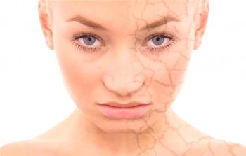 Pojav pigmentnih madežev na obrazu in telesu: vzroki in zdravljenje