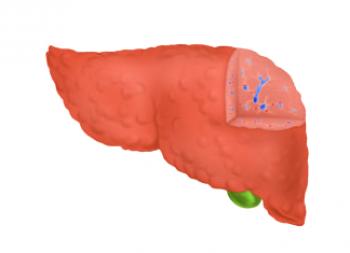 Prehrana z mastno hepatozo