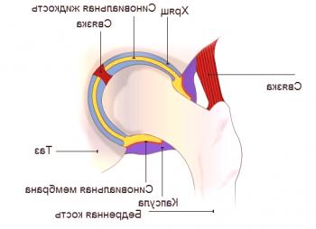 Causas y tratamiento de la sinovitis de la articulación de la cadera.