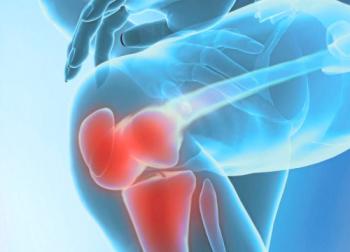Artritis de la articulación de la rodilla: métodos efectivos de tratamiento.