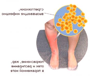Remedios populares populares para el tratamiento de piernas y pies.