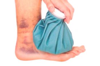 Vzroki in zdravljenje hematoma na nogi