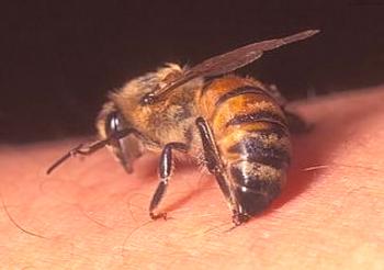 Kaj naj naredim, če sem ugrizel čebelo ali ražo?