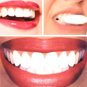 Beljenje belih zob: sijoč nasmeh brez dragih storitev