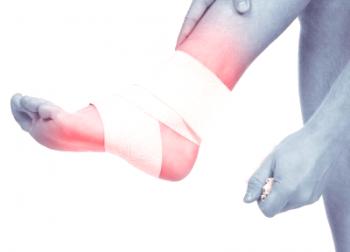 Tratamiento de la artrosis del pie: desde la inyección hasta las sanguijuelas.