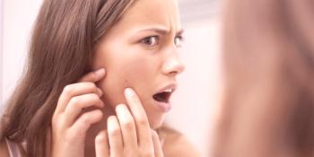 ¿Cómo deshacerse rápidamente del acné hipodérmico en la cara?
