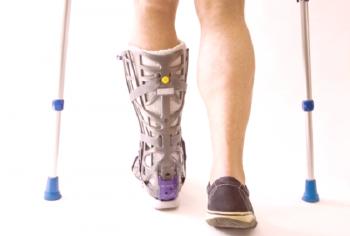 ¿Cuáles son los síntomas de una fractura en el hueso de la pierna?