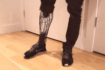 Moderna protetika za noge - kaj so?