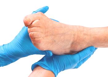 ¿Cómo es el tratamiento de los tobillos en el dedo gordo del pie en el hogar?