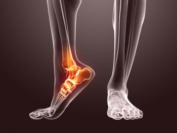 El tobillo está doloroso e inflamado: ¿una lesión o una enfermedad grave?