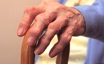 Revmatoidni artritis: definicija in diagnoza