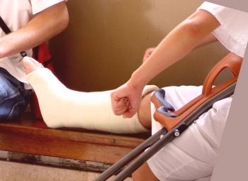 El proceso de rehabilitación tras una fractura de pierna.
