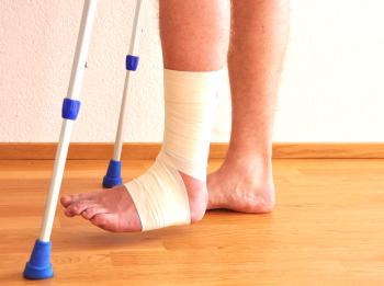 Si después de una fractura la pierna se inflama, ¿qué se puede y qué no se puede hacer?