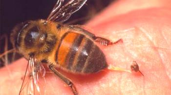 ¿Qué mordida peligrosa de una abeja?