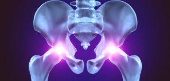 Gimnasia y masaje en el tratamiento de la artrosis de la articulación de la cadera en el hogar.