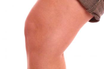 Sinovitis de la articulación de la rodilla: tratamiento con métodos conservadores y quirúrgicos.
