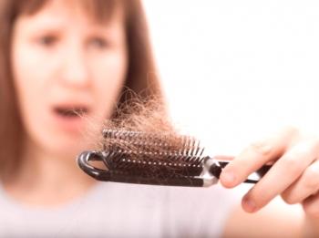 Vzroki za izpadanje las pri ženskah
