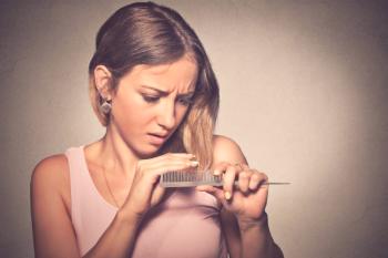 Las principales causas de pérdida de cabello en las mujeres y los problemas de tratamiento.