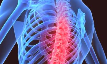 Osteocondrosis del trastorno torácico: síntomas, tratamiento