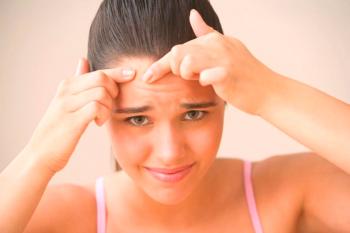 ¿Por qué el acné está en la frente y cómo deshacerse de ellos?