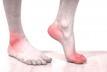 Dolor local en el pie al caminar: causas posibles