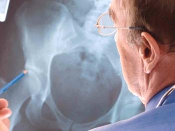 Artritis de la articulación de la cadera: causas de síntomas y tratamiento.