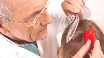 Zdravljenje uši pri otrocih doma