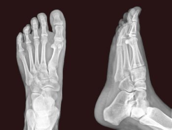 Radiografías y otros métodos de diagnóstico de patología del pie.