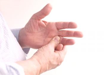 Artritis del dedo: diagnóstico, tratamiento y prevención de la enfermedad.