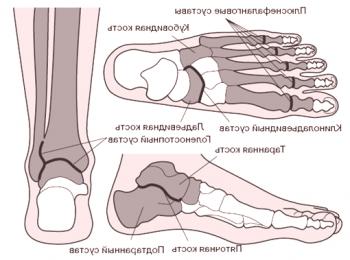 Artritis in artroza stopala
