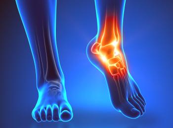 Impactos y dislocaciones de la pierna en la región del tobillo.