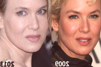 Fotos de la actriz Rene Zellweger - antes y después del plástico.