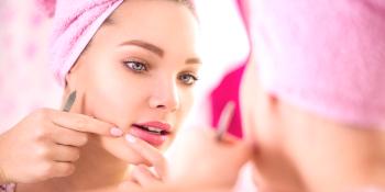 ¿Cómo deshacerse rápidamente del acné en tu cara en casa?Remedios populares para el acné y el acné.