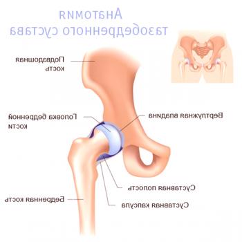 Especificidad de la inflamación de la articulación de la cadera: síntomas y tratamiento en adultos y niños
