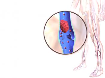 ¿Por qué surge y cómo se trata la tromboflebitis de las extremidades inferiores?