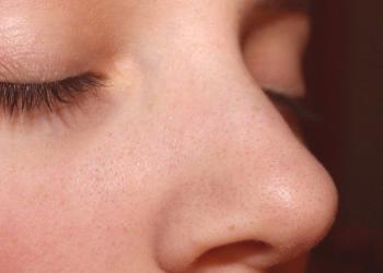 Kako se znebiti črnih pik na nosu deklet?