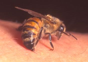 Apioterapia, tratamiento de las picaduras de abejas, veneno de abejas, técnicas, historia,