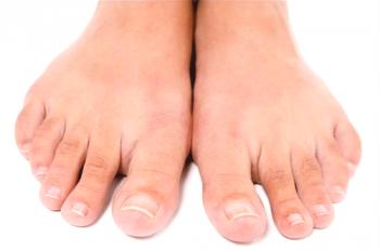 Cómo tratar la picazón entre los dedos de los pies