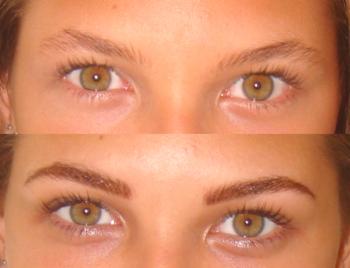 Ejemplos de laminación de cejas con fotos antes y después del procedimiento.