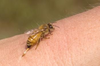 Tratamiento de la hernia por las abejas, la eficacia del método.